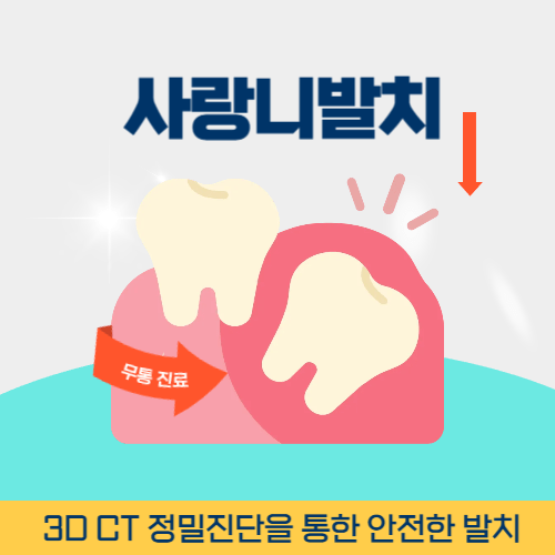 오산치과 오산시 치과 사랑니 발치