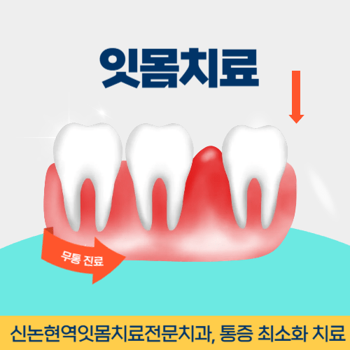 오산치과 오산시 치과 잇몸치료